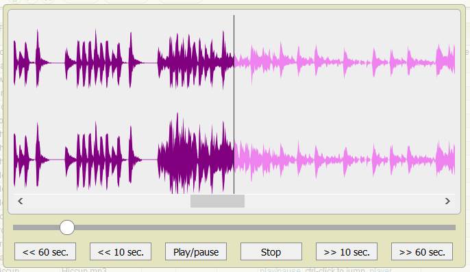 5gVision Release notes, Media 4